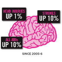brain-injury-stats-2018-brain